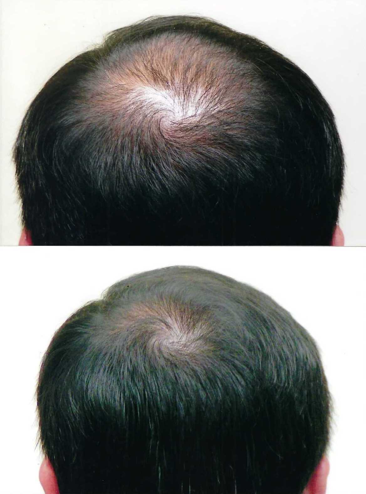 66bbf88db0d8fe8a4811ee0b_Photo_2023-03-02_104625