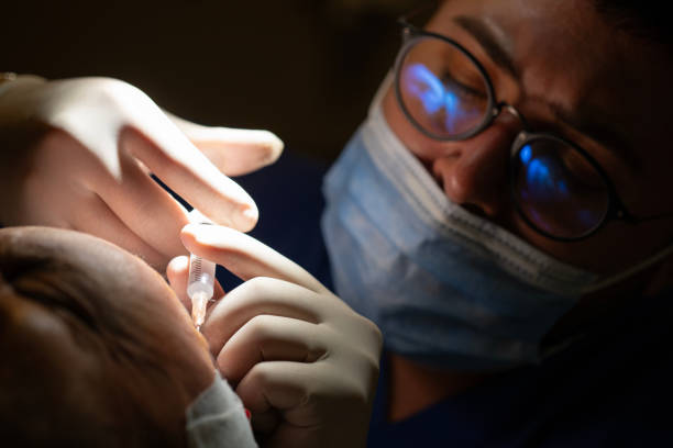 The doctor is injecting anesthesia into the area to be treated using a syringe. This step is crucial for ensuring the procedure is painless and comfortable. The photo captures an essential preparation step in the hair transplant process